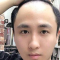 快手脸上纹jb的网红,纹jb背后的故事与争议